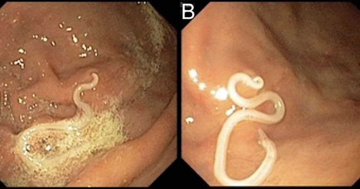 Cover Image for Doctors Are Now Warning That You Might Be Infected With A Deadly Parasite If You Eat Sushi!