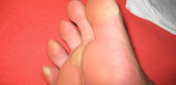 Cover Image for 11 Reasons Your Feet Are Aching