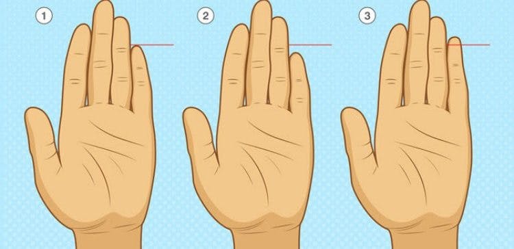Cover Image for If Your Pinkie Finger is Really Short, Here’s What It Could Say About You
