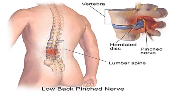 Cover Image for The Secret To Back Pain Is In Your Feet! The 5 Exercises That Fix Everything!